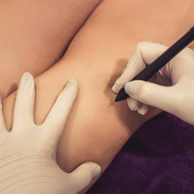 ELECTROLYSIS